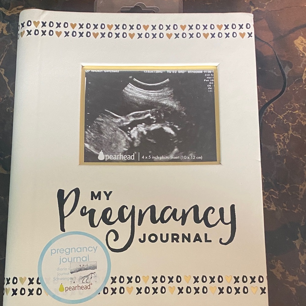 Pearhead My Pregnancy Journal - White with Black and Gold Accents